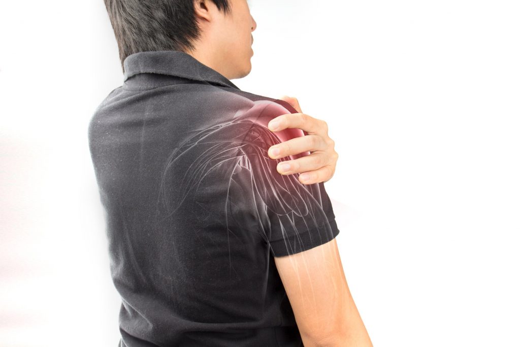 Nerve Blocks