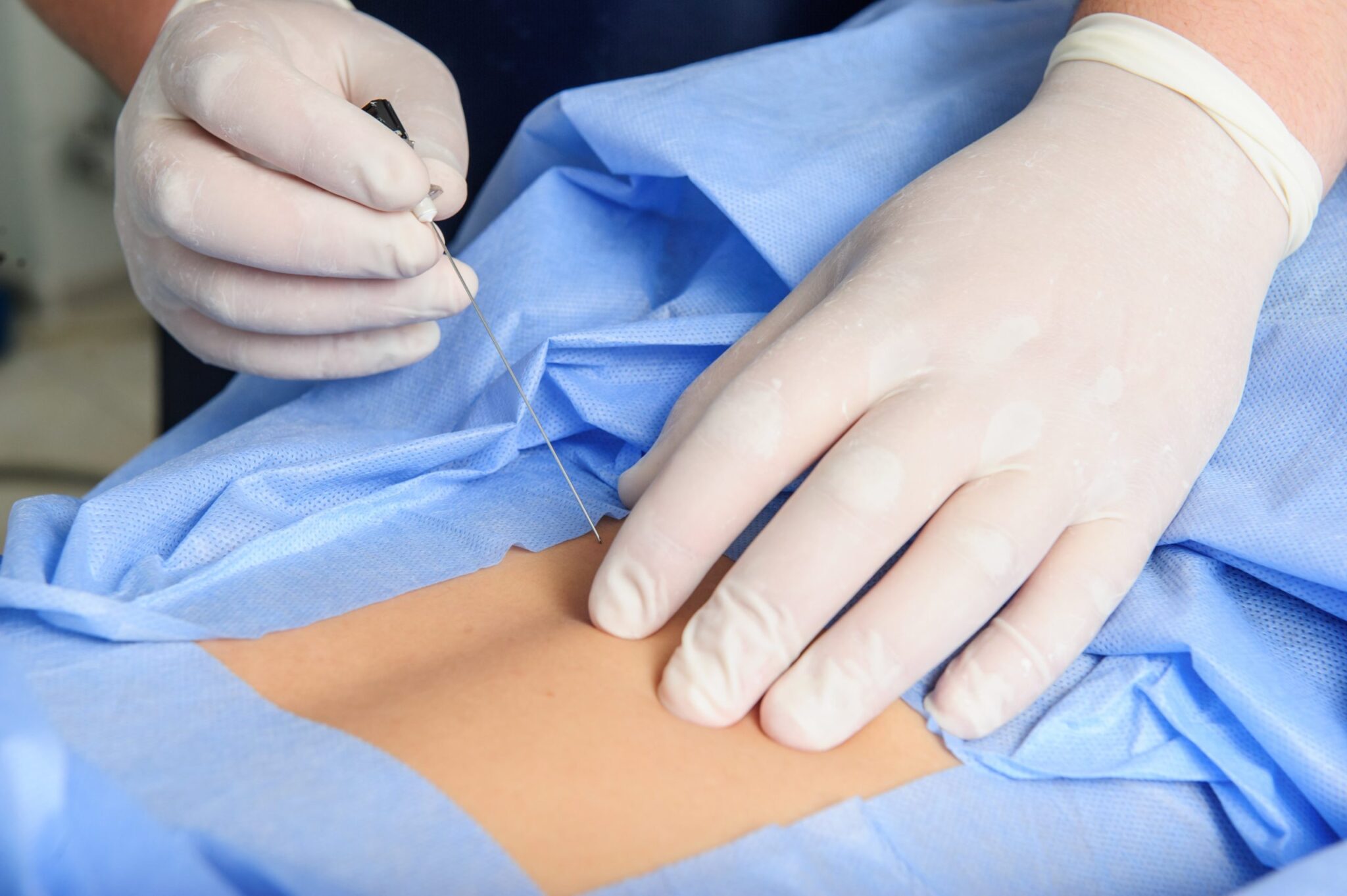 Facet Joint Injections NJ | Vascura Pain & Vein Clinic