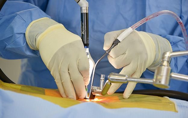 Minimal-Invasive-Spine-Surgery