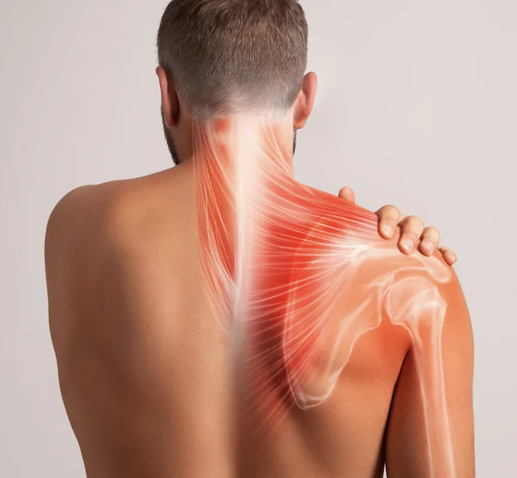Shoulder-Pain